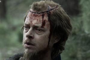 Close up of Jacob Pratt (Dane DeHaan) and his gnarly head wound sewn up